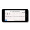 ProMedix PR-650 Android, iOS, EKG, Pulzus és Vérnyomásmérős Vízálló Fekete aktivitásmérő karpánt